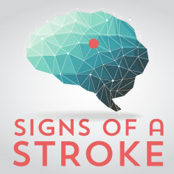 signs of stroke